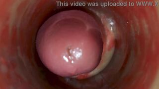 Camera Inside Deep Pussy Captures Huge Ejaculation of Sperm ASMR